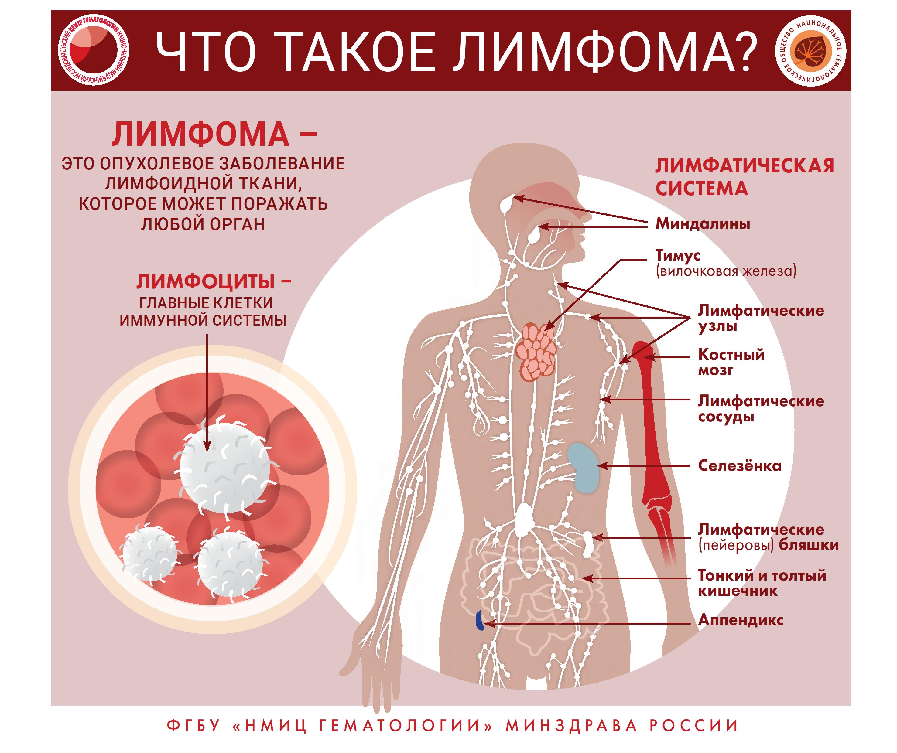 Инфографика 0006